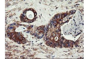 Image no. 1 for anti-Ubiquitin-Conjugating Enzyme E2, J1, U (UBE2J1) antibody (ABIN1501637)