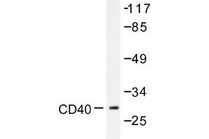 Image no. 1 for anti-CD40 (CD40) antibody (ABIN271944) (CD40 anticorps)