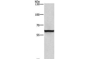 Western Blot analysis of A431 cell using TRIP4 Polyclonal Antibody at dilution of 1:400 (TRIP4 anticorps)