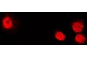 Immunofluorescent analysis of ATIC staining in U2OS cells.