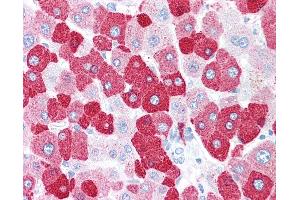 Anti-LOXL2 antibody IHC of human liver.