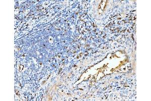 IHC analysis of Hemoglobin/HBA1/HBA2 using anti-Hemoglobin/HBA1/HBA2 antibody (ABIN7602893).