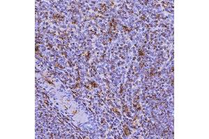 IHC analysis of SEPT6/SEPTIN6 using anti-SEPT6/SEPTIN6 antibody (ABIN7599390). (Septin 6 anticorps  (AA 1-434))