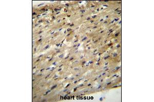 ABCD2 Antibody (C-term) (ABIN656554 and ABIN2845816) immunohistochemistry analysis in formalin fixed and paraffin embedded human heart tissue followed by peroxidase conjugation of the secondary antibody and DAB staining. (CCL17 anticorps  (C-Term))