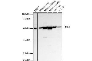 Western blot analysis of extracts of various cell lines, using ME1 antibody (ABIN1680809, ABIN3018339, ABIN3018340 and ABIN6220439) at 1:500 dilution. (ME1 anticorps  (AA 1-300))