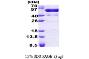 SDS-PAGE (SDS) image for Proline-serine-threonine Phosphatase Interacting Protein 1 (PSTPIP1) (AA 1-416) protein (His tag) (ABIN5853033)