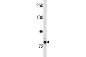 Western Blotting (WB) image for anti-Zinc Finger Protein 12 (ZNF12) antibody (ABIN3004528) (ZNF12 anticorps)