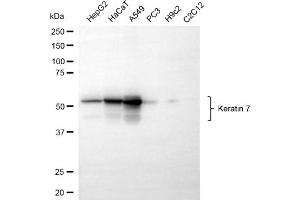 Western blotting analysis using keratin 7 antibody (ABIN7799185).