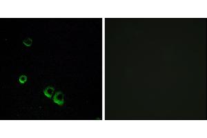 Immunofluorescence analysis of MCF-7 cells, using AVPR2 antibody. (AVPR2 anticorps)