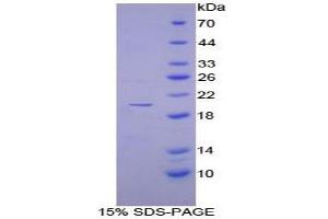 SDS-PAGE analysis of Human DISC1 Protein. (DISC1 Protéine)