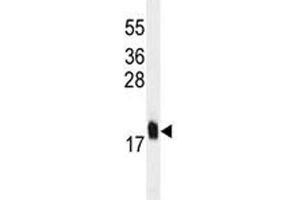 MCFD2 antibody western blot analysis in U251 lysate. (MCFD2 anticorps)