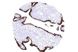 First trimenon placenta showing an intense cytoplasmic KISS1 staining of syncytiotrophoblast cells (Recombinant KISS1 anticorps)