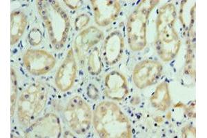 Immunohistochemistry of paraffin-embedded human kidney tissue using ABIN7143737 at dilution of 1:100 (FUT6 anticorps  (AA 170-359))