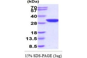 SDS-PAGE (SDS) image for Adenylate Kinase 2 (AK2) (AA 1-239) (Active) protein (His tag) (ABIN5855039)