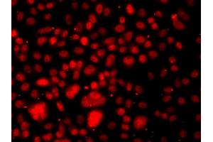 Immunofluorescence analysis of A549 cells using RELA antibody. (NF-kB p65 anticorps)