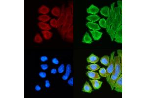 ABIN6261558 and ABIN6268802 staining Hela cells(30 min of UV treatment) by IF/ICC. (EPH Receptor A3 anticorps  (C-Term))