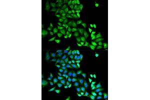 Immunofluorescence (IF) image for anti-GDP Dissociation Inhibitor 1 (GDI1) antibody (ABIN1876650) (GDI1 anticorps)