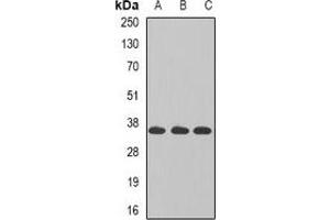 Western blot analysis of TAMM41 expression in MCF7 (A), K562 (B), Jurkat (C) whole cell lysates. (TAM41 anticorps)