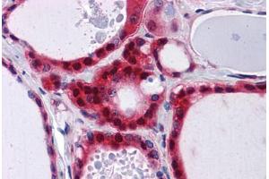 Human Thyroid: Formalin-Fixed, Paraffin-Embedded (FFPE)