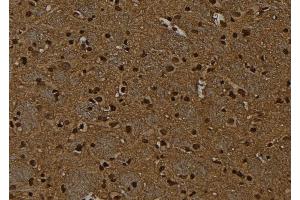 ABIN6267090 at 1/100 staining Rat brain tissue by IHC-P. (RUNX1 anticorps  (pSer249))