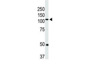 Western blot analysis of BMPR2 antibody and mouse heart tissue lysate