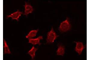 ABIN6272358 staining MCF7 by IF/ICC. (NEURL anticorps  (Internal Region))