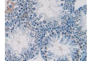 Detection of SDF1 in Mouse Testis Tissue using Polyclonal Antibody to Stromal Cell Derived Factor 1 (SDF1)