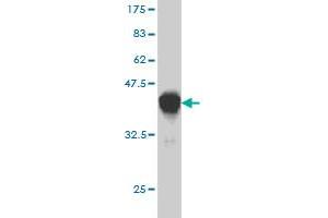 Western Blot detection against Immunogen (40.