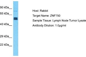 Host: Rabbit Target Name: ZNF750 Sample Type: Lymph Node Tumor lysates Antibody Dilution: 1. (ZNF750 anticorps  (N-Term))