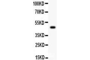 Anti-CSK Picoband antibody,  All lanes: Anti CSK  at 0. (CSK anticorps  (AA 2-204))