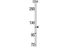 Western blot analysis of TNK2 polyclonal antibody  in CEM cell line lysates (35 ug/lane). (TNK2 anticorps  (C-Term))