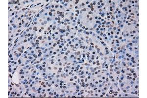 Immunohistochemical staining of paraffin-embedded pancreas tissue using anti-MAPK12mouse monoclonal antibody. (MAPK12 anticorps)