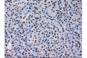 Immunohistochemical staining of paraffin-embedded pancreas tissue using anti-MAPK12mouse monoclonal antibody.