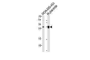 Western blot analysis of lysates from MDA-MB-453 cell line, human placenta tissue lysate (from left to right), using FOLR2 Antibody (N-term) (ABIN651222 and ABIN2840139).