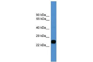 WB Suggested Anti-UCHL1 Antibody Titration: 0. (UCHL1 anticorps  (C-Term))