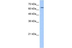 Western Blotting (WB) image for anti-Solute Carrier Family 22 (Organic Cation Transporter), Member 11 (SLC22A11) antibody (ABIN2462761)
