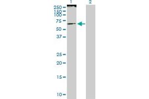 Western Blot analysis of SMARCE1 expression in transfected 293T cell line by SMARCE1 MaxPab polyclonal antibody. (SMARCE1 anticorps  (AA 1-411))