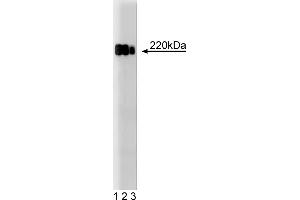 Western Blotting (WB) image for anti-Tight Junction Protein 1 (TJP1) (AA 1048-1247) antibody (ABIN968283) (TJP1 anticorps  (AA 1048-1247))