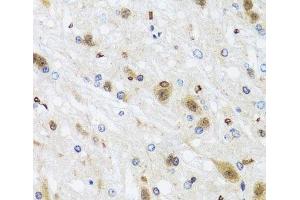 Immunohistochemistry of paraffin-embedded Rat brain using HDAC4 Polyclonal Antibody at dilution of 1:100 (40x lens). (HDAC4 anticorps)