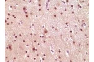 Immunohistochemistry (IHC) image for anti-ELK1, Member of ETS Oncogene Family (ELK1) (truncated) antibody (ABIN2464047)