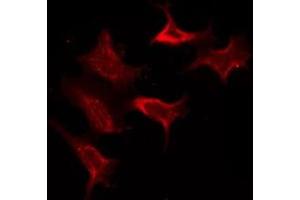 ABIN6278601 staining COLO205 by IF/ICC. (OR10X1 anticorps  (Internal Region))