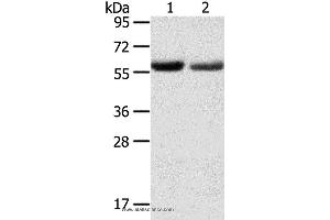 Western blot analysis of Human normal stomach and stomach cancer tissue, using SLC16A9 Polyclonal Antibody at dilution of 1:200 (SLC16A9 anticorps)