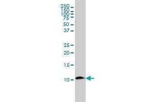 B2M monoclonal antibody (M01), clone 3F9-2C2 Western Blot analysis of B2M expression in U-2 OS .