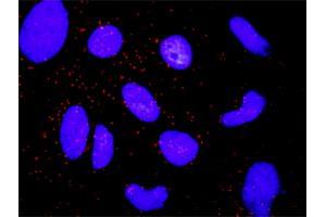 Proximity Ligation Analysis of protein-protein interactions between ARRB2 and CTNNA1.