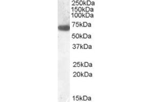 Image no. 1 for anti-Glucokinase (Hexokinase 4) Regulator (GCKR) (N-Term) antibody (ABIN375154) (GCKR anticorps  (N-Term))