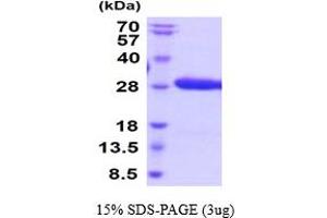 Ephrin B3 (EFNB3) (AA 28-226) protein (His tag)