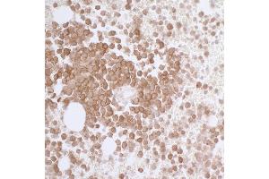 Immunohistochemistry (IHC) image for anti-CD33 (CD33) (AA 314-364) antibody (ABIN7453876) (Recombinant CD33 anticorps  (AA 314-364))