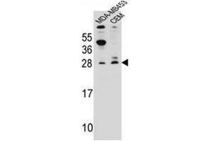 IFI6 Antibody (N-term) western blot analysis in MDA-MB453,CEM cell line lysates (35µg/lane). (IFI6 anticorps  (N-Term))