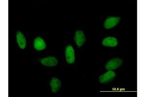 Immunofluorescence of purified MaxPab rabbit antibody to CBX5 on HeLa cell. (CBX5 anticorps  (AA 1-191))