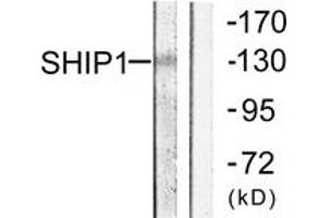 Western blot analysis of extracts from mouse brain cells, using SHIP1 (Ab-1020) Antibody. (INPP5D anticorps  (AA 987-1036))